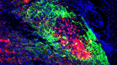 Shell neurons, colored in green, project to the brain's breathing center in the brainstem. Core neurons, colored red, project to the pain/emotion center called the amygdala. Salk Institute, CC BY-NC-ND