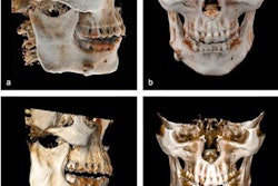 2022 02 15 00 41 2125 2022 02 15 Cinematic Rendering 20220215002509