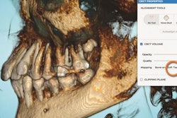 2022 02 22 00 10 6419 2022 02 22 Spark Clear Aligners Release 12 20220222005553