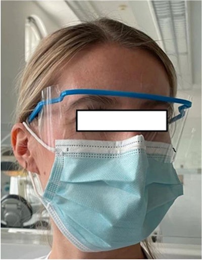 Protective eyewear worn by a participant prior to performing dental treatment. Image courtesy of Bergmann et al. Licensed under CC BY 4.0.