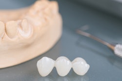 2021 05 28 22 43 5076 3 D Impression Bridge 400