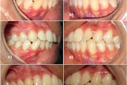 2022 04 12 22 25 9426 2022 04 19 Dental Photography Cameras 400