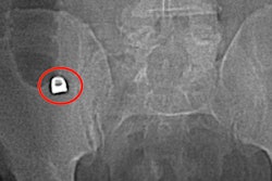 2022 04 15 18 31 0333 2022 04 15 Tooth Appendicitis 400