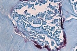 2022 04 20 16 08 7324 2022 04 20 Nidcr Bone Degrating Cells 400