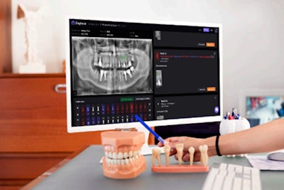 Diagnocat AI converts 3D DICOM files and segments them into STL files. Image courtesy of Diagnocat.