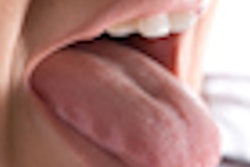 2020 05 21 18 58 0471 Tongue 400
