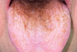 2022 05 10 23 30 8059 2022 05 11 Bht 400