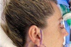 2022 05 18 15 08 0175 2022 05 19 Ultrasound Gel 400