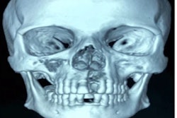 2022 06 17 16 29 6533 2022 06 17 Covid 19 Osteonecrosis 400