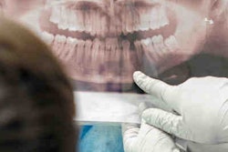 2022 06 27 14 37 0592 Doctor Shows Boy Teeth Xray 400