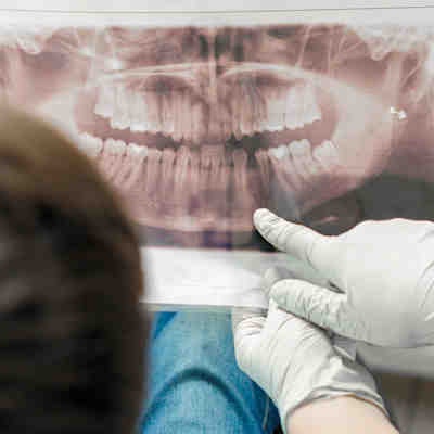 2022 06 27 14 37 0592 Doctor Shows Boy Teeth Xray 400