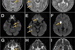2022 06 29 15 50 6208 2022 06 Perio Brain 400