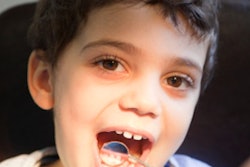 2016 09 30 15 08 36 946 Boy Dental Exam 400