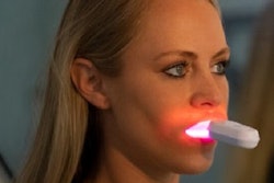 2022 07 01 21 44 1302 2022 07 01 Star Aligners Illumina Oral Therapy 400