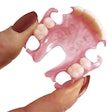 2022 07 21 18 01 1429 2022 07 20 Impress3 D Partial Denture 400