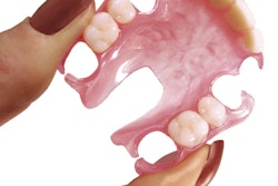 2022 07 21 18 01 1429 2022 07 20 Impress3 D Partial Denture 400