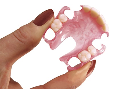 Impress3D has launched its digital solution for removable partial dentures. Image courtesy of Impress3D.