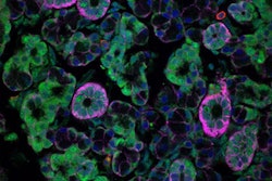 2022 07 28 19 06 3940 2022 07 28 Enteric Viruses Saliva 400