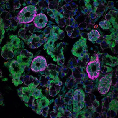 In a mouse, a microscopic view shows salivary gland acinar epithelial cells (pink) infected with rotavirus (green), a type of enteric virus. Image courtesy of the National Institutes of Health.
