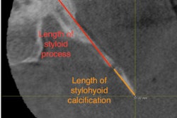 2022 07 29 16 46 2183 2022 07 Calcified Sh Ls 400