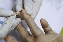 2022 08 03 17 31 4420 Fingerprick Blood 400