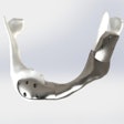 2022 08 09 15 38 0445 2022 08 09 Nci Titanium Jaw 400