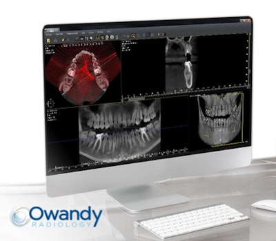 The implant planning guide. Image courtesy of Owandy Radiology.