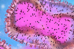 2022 08 17 20 26 7350 Monkeypox Virus 400