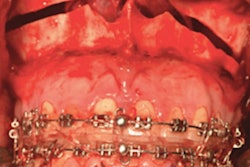 2022 08 29 15 32 4924 2022 08 29 Swallowing Syncope Fig1 400