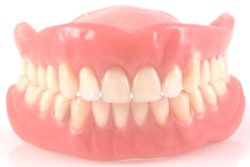 2017 03 17 16 12 13 771 Dentures 400