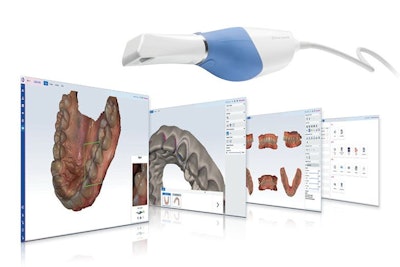 The Planmeca Romexis CAD/CAM module. Image courtesy of Planmeca.