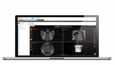 Sensei Cloud for Oral Surgery. Image courtesy of Carestream Dental.