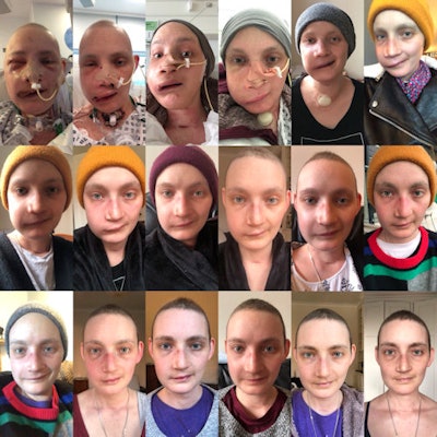 Taylor provides blog readers with an update on her postsurgery healing in May 2018. All images courtesy of Jen Taylor.
