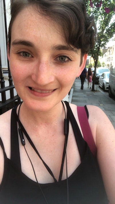 Taylor smiling with her new set of teeth.