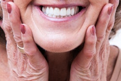 2022 11 15 18 09 7668 Dentures Woman Smiling 400