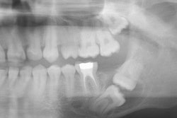 2022 11 17 18 12 0459 2022 11 17 Kissing Molars Radio 400