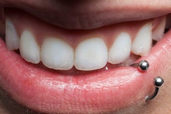 2022 12 09 23 31 4939 Mouth Piercing Closeup 400