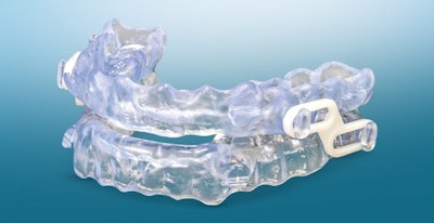 The EndSnorZ sleep appliance. Image courtesy of New West Dental Lab.