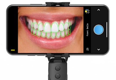 The Grip & Shoot iPhone app. Image courtesy of G&S Dental.