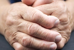 2022 12 19 21 44 6731 Hands Arthritis Rheumatoid 400