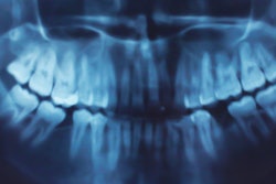 2022 12 23 17 41 8992 X Ray Dental Panoramic 400