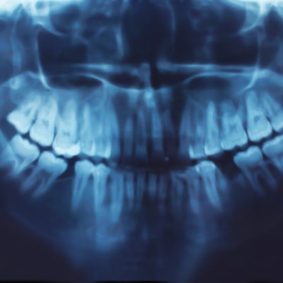 2022 12 23 17 41 8992 X Ray Dental Panoramic 400