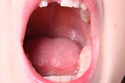 2020 04 09 23 58 6081 Kid Open Mouth 400