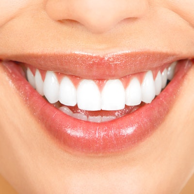 2020 08 26 17 20 2673 Smile3 400