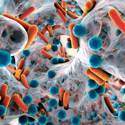 2022 07 28 00 54 0417 Antibiotic Resistant Bacteria 400