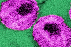 2023 01 20 00 33 8130 Hiv Virions Cdc 400