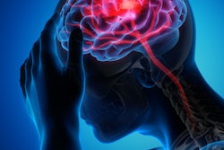 2023 01 31 16 54 5495 Brain Stroke 400