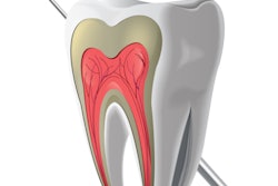 2016 10 04 13 57 40 48 Tooth Pulp Endodontic 400