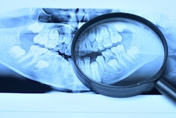 2019 05 08 18 37 9079 X Ray Dental Magnifying Glass 400