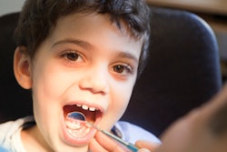 Boy Dental Exam